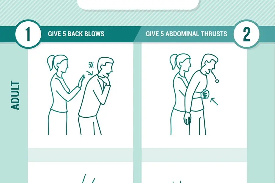 First aid procedure for choking and heimlich maneuver for adults and infants