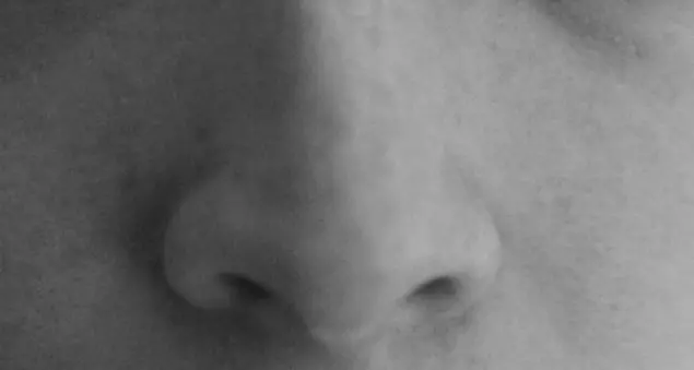 Rinite allergica. Ascoltiamo il nostro naso