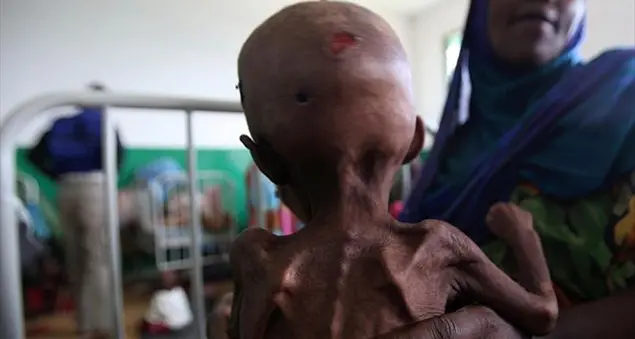 3,1 milioni di bambini muoiono di fame ogni anno