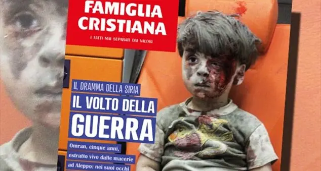Perché ci infastidiscono i bambini vittime della guerra