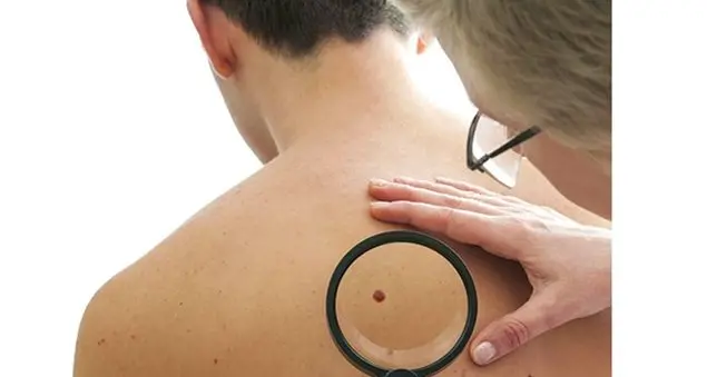 Come controllare e difendere la nostra pelle