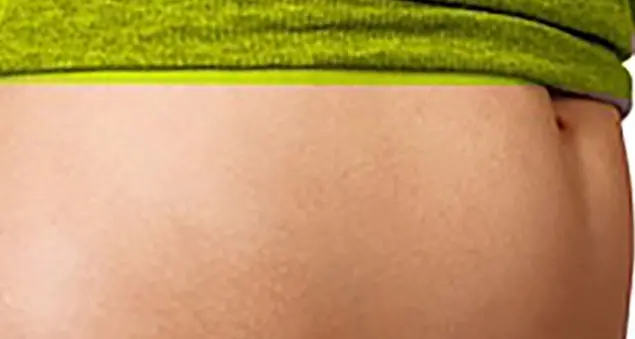 Semplici consigli per risvegliare l'intestino pigro