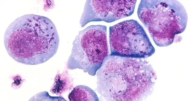 Herpes Zoster: il Fuoco di sant'Antonio si diffonde, come difendersi?