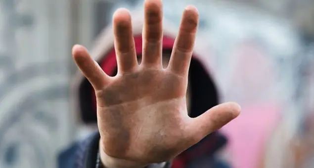 Bruciato dal branco: un male assoluto senza spiegazioni