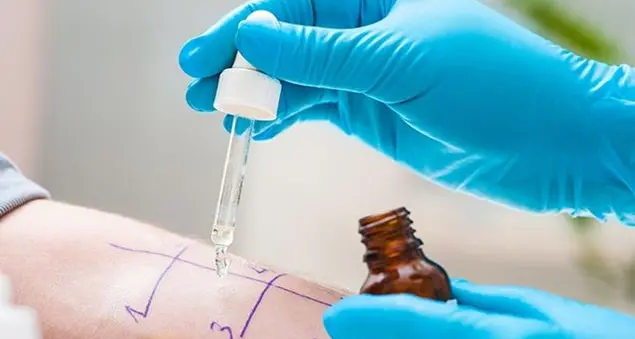 Allergie e intolleranze alimentari: come affrontarle