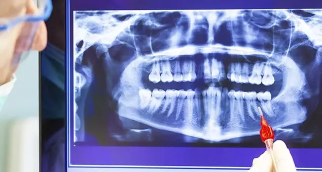 Le cattive abitudini che fanno male alle gengive: ecco quali evitare
