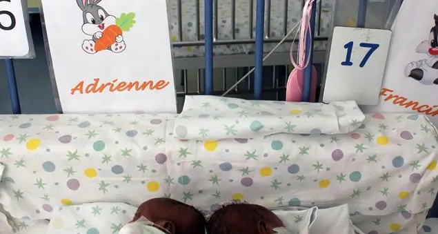 Separate a Roma le gemelline siamesi del Burundi