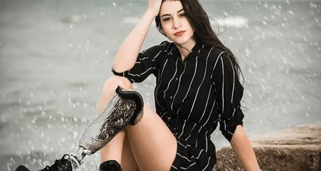 Insulti alla miss con la protesi