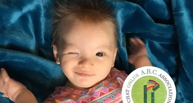 Timmy ha una sindrome rara: «Ma Famiglia Cristiana non ci ha lasciati soli»