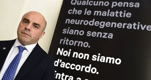 Sclerosi multipla, terminata la prima fase con il trapianto di staminali su 15 malati