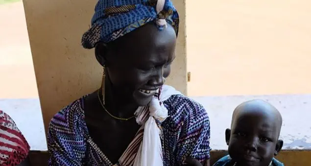 Come un chirurgo del Cuamm ha salvato la vita a un bambino africano gravemente ustionato
