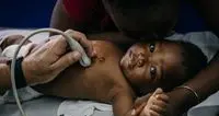 \"Cuori ribelli\", il programma sanitario che salva i bimbi dell'Africa dalle cardiomiopatie
