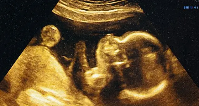 «Bambini sono anche coloro che viaggiano verso la nascita»