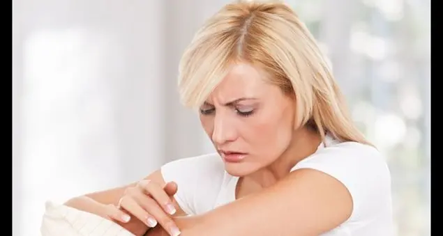 Orticaria, i cibi da evitare e i farmaci migliori