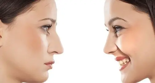 Chiururgia estetica: vero e falso