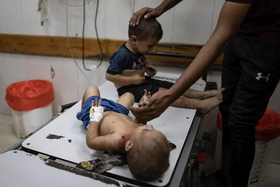 Bambini feriti vengono cuirati all\\'ospedale Nasser di Khan Younis, dopo un attacco israeliano contro una tenda che ospitava sfollati a Khan Younis, nella Striscia di Gaza meridionale , EPA