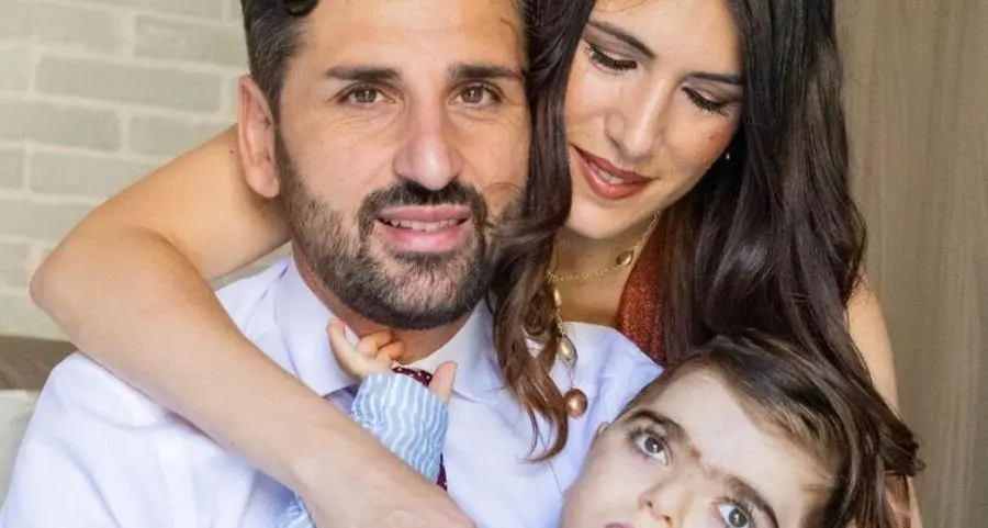 «Desidero vedere mio figlio libero di scegliere il suo futuro», Manuela racconta la storia di Mario, bimbo con la sindrome di Chops
