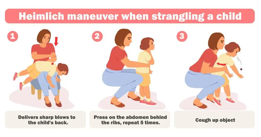 Child help with choking infographic poster vector illustration. First aid CPR emergency help for kids with blocked swallow and breath due to food obstruction