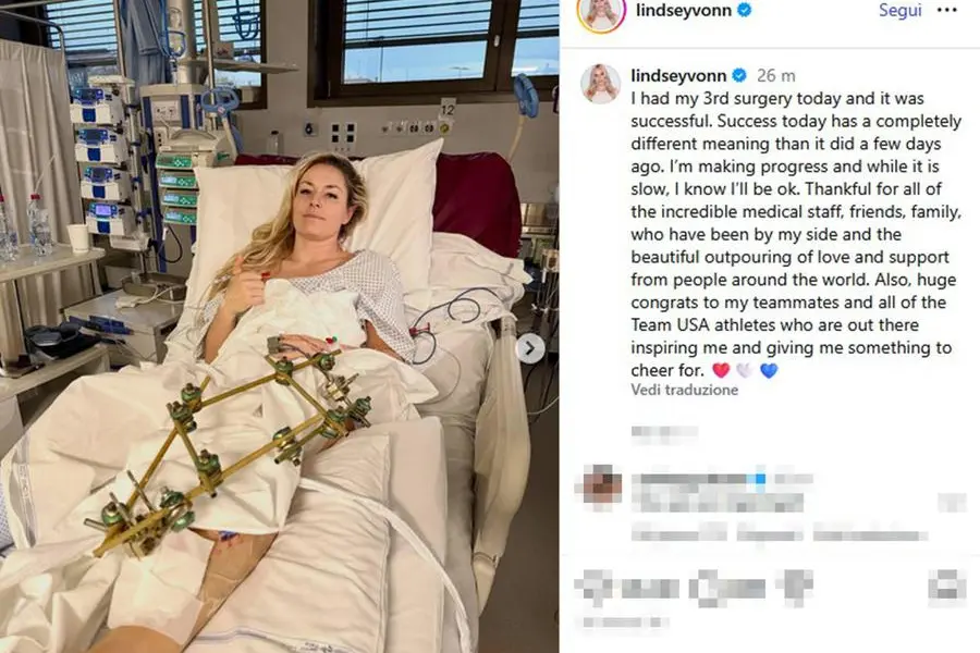 Una foto postata sul suo profilo Instagram dalla sciatrice Lindsey Vonn, ricoverata all'Ospedale Ca' Foncello dopo la caduta sull'Olympia delle Tofane durante la gara di discesa libera di domenica scorsa. L'atleta statunitense è stata operata alla gamba, 'tre interventi effettuati oggi, è stato un successo'. Roma, 11 febbraio 2026. INSTAGRAM LINDSEY VONN +++ ANSA PROVIDES ACCESS TO THIS HANDOUT PHOTO TO BE USED SOLELY TO ILLUSTRATE NEWS REPORTING OR COMMENTARY ON THE FACTS OR EVENTS DEPICTED IN THIS IMAGE - NO ARCHIVING - NO LICENSING - NPK +++