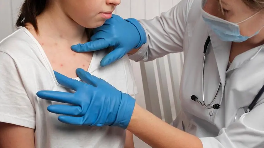 Morbillo, aumentano i casi in Italia: chi rischia di più e come proteggersi