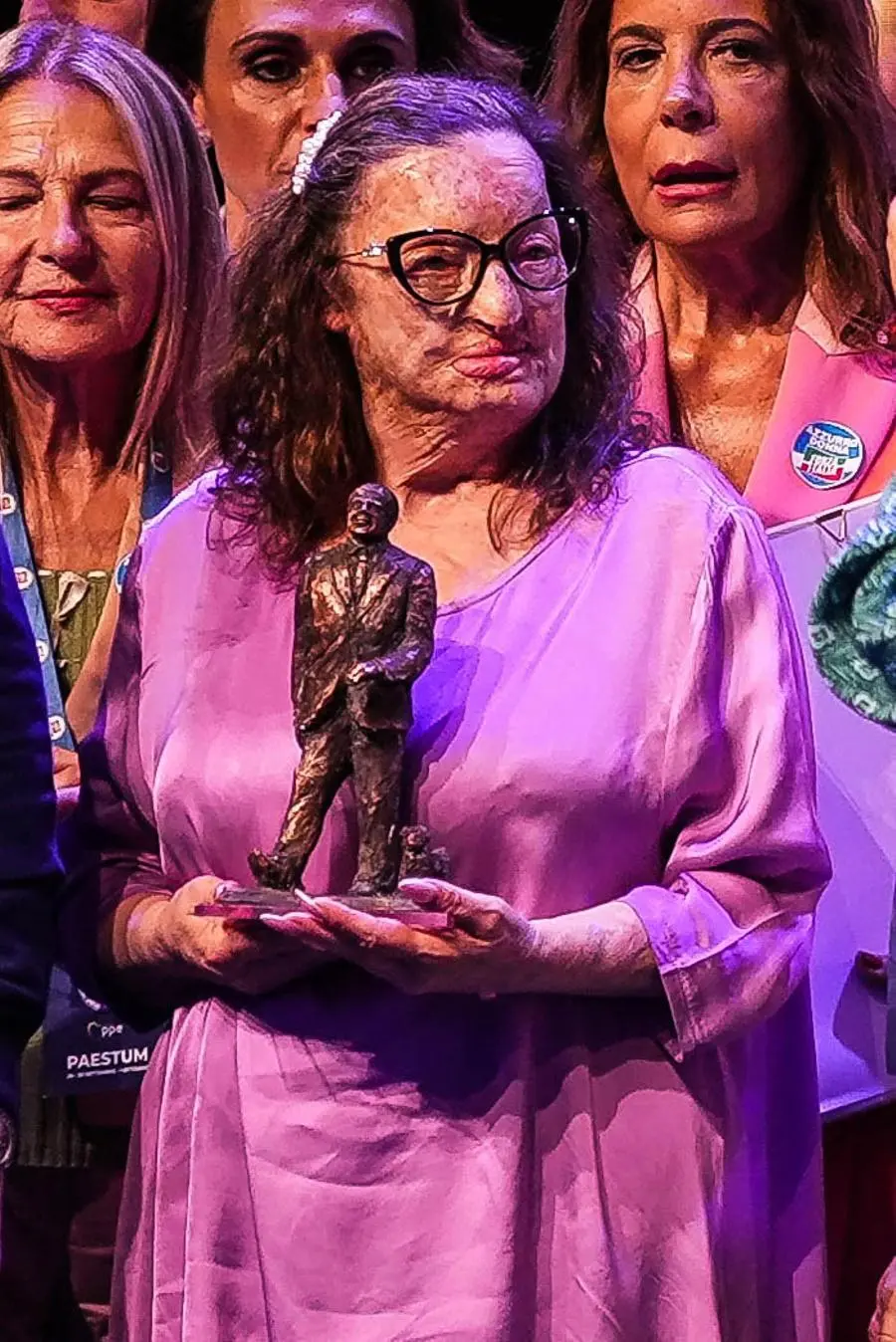 Filomena Lamberti, sfregiata con l\\'acido dal marito il 28 maggio del 2012 , ANSA