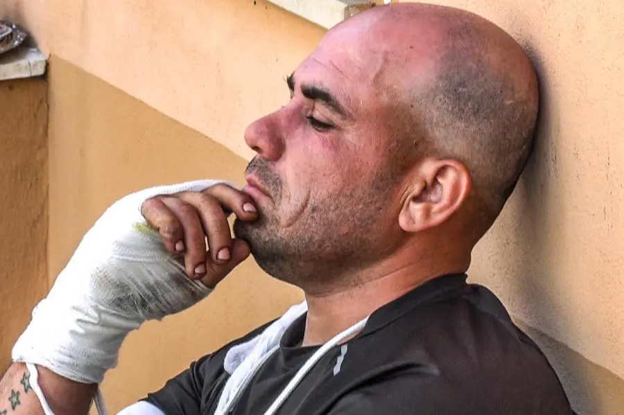 Il 35enne afghano, Mohammad Taj Alamyar, rimasto gravemente ustionato ma vivo nel tragico rogo del minivan avvenuto lunedì scorso nell'area di servizio di Amendolara, costato la vita a quattro persone, 4 giugno 2026